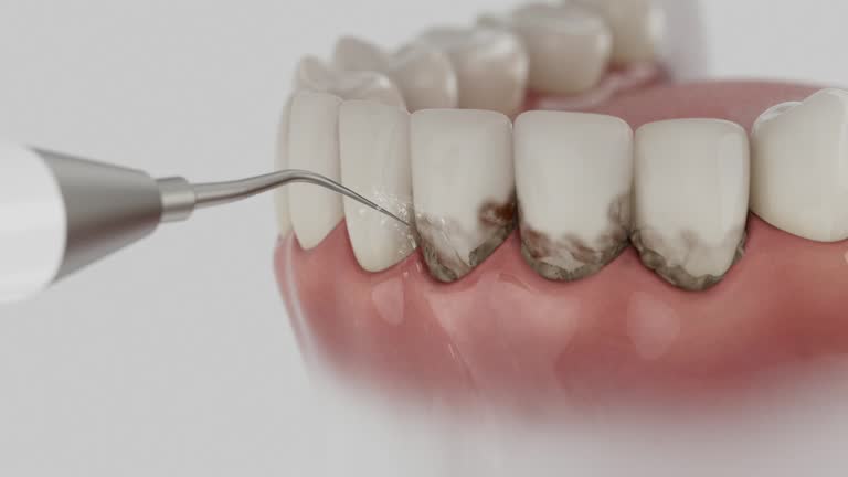 Trusted Emergency Dentist service in Avoca, PA - Dentist Open Now
